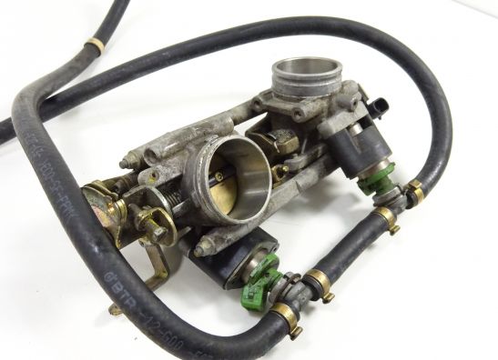 Einspritzanlage Ducati ST2